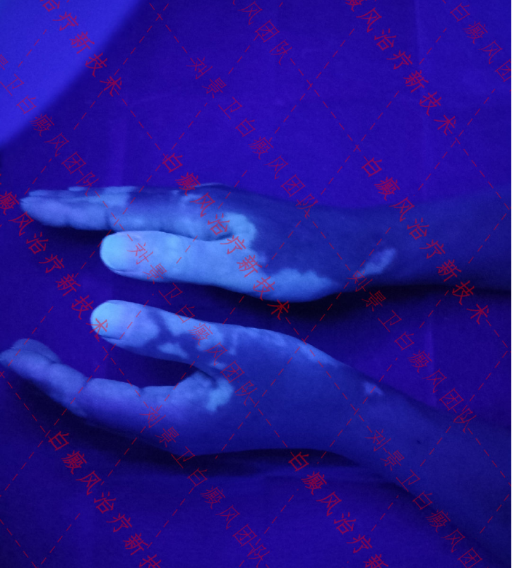 1639011485156163.png