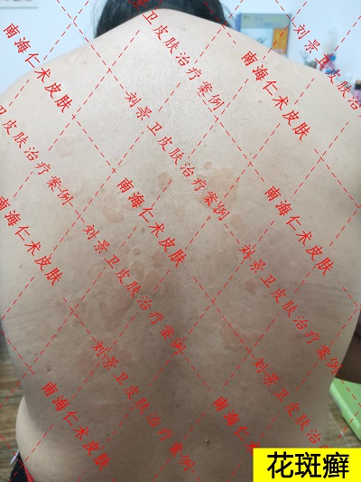 花斑藓.jpg