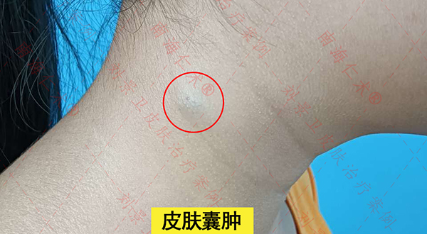 海口哪家医院比较好.jpg