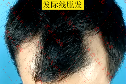 海口仁术皮肤.png