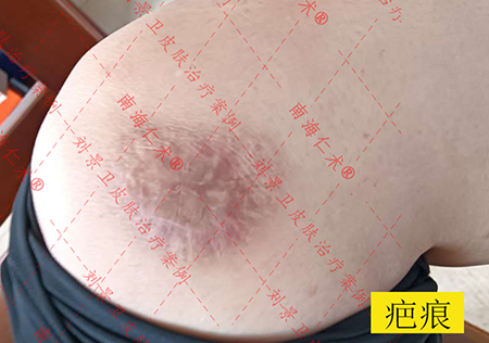 海口仁术皮肤.jpg