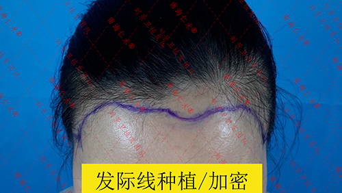 海口仁术皮肤.jpg