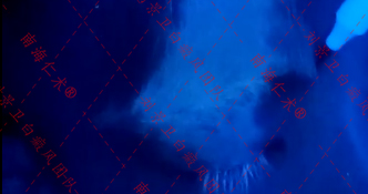 白癜风新疗法.jpg