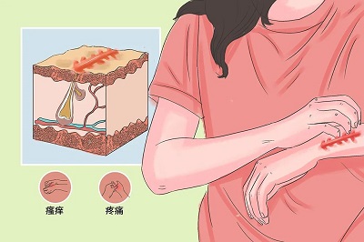 疤3.jpg