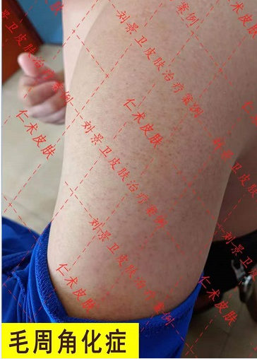 微信截图_20230826150943.png