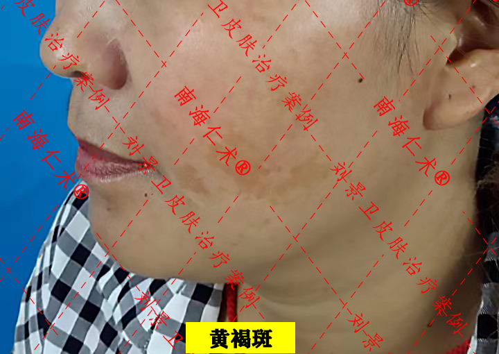 1694075071431094.jpg