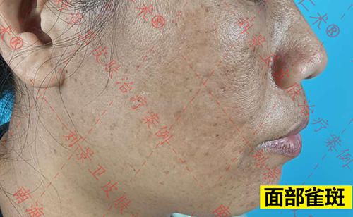 海口仁术皮肤.jpg