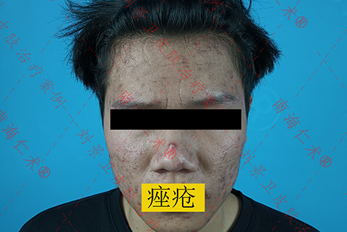 海口仁术皮肤.jpg