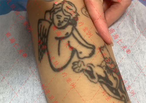 海口仁术皮肤.png