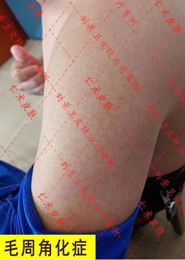 微信截图_20231204151731.png