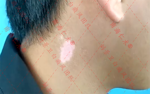 海口仁术皮肤.png