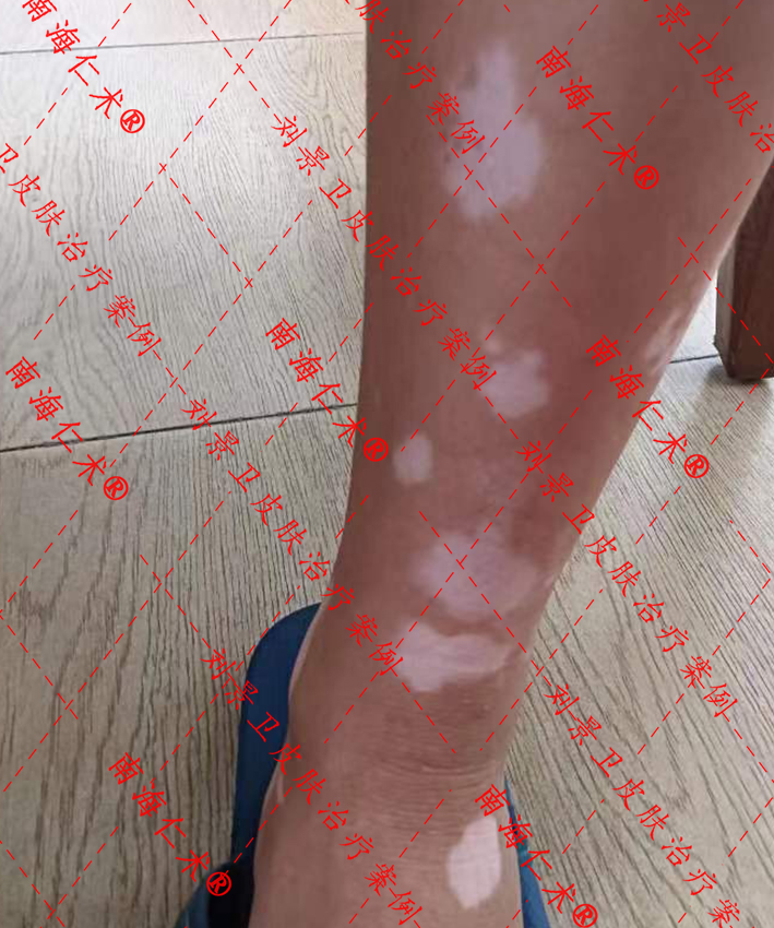 1703044661139363.jpg