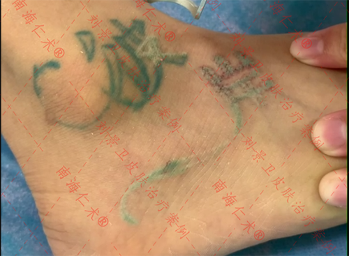 海口仁术皮肤.png
