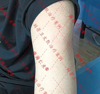 微信截图_20240108153227.png