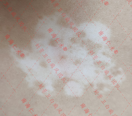 术前.jpg