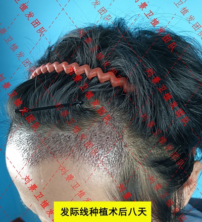 发际8.jpg