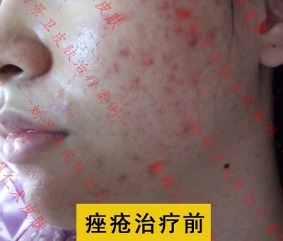 微信截图_20240326141424.png