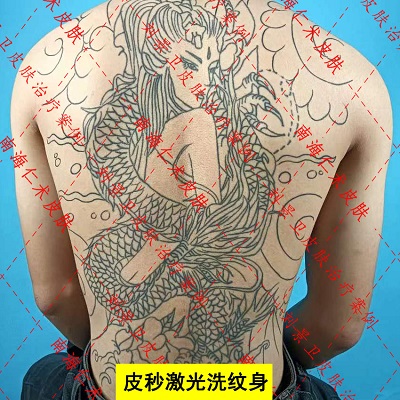 洗纹身满背.jpg