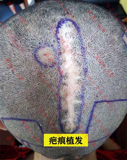 b6947148be15da2b1d4b5fc9ab2937a.png