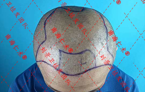 iwEcAqNqcGcDAQTRA8AF0QUABrAWirOoO6A9FAbBiloRISUAB9MAAAAAoPg_BggACaJpbQoAC9IAAXTW.jpg_720x720q90.jpg