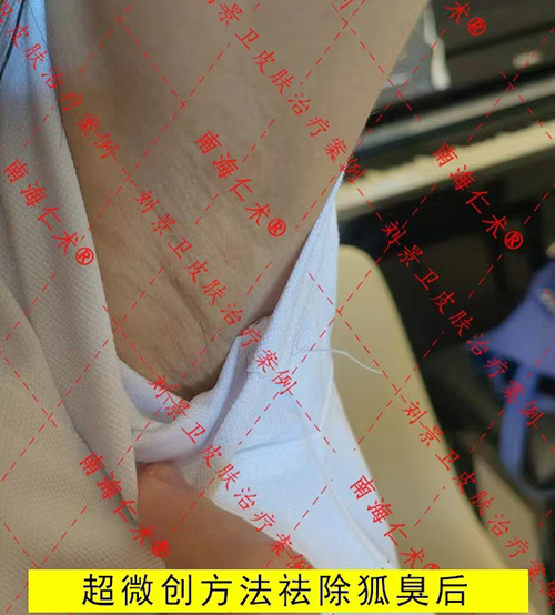 aa3e2abcc34810952b982c20cf2f89d.jpg